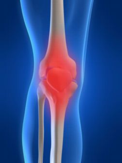 膝痛の本当の原因